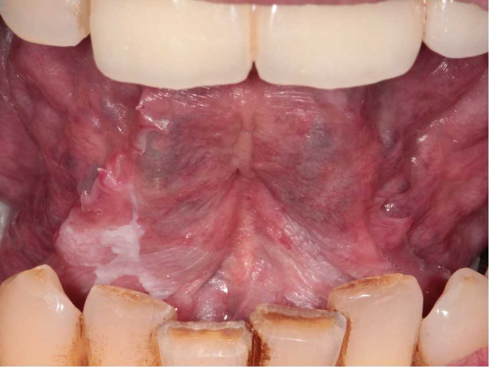 Oral pathology 4