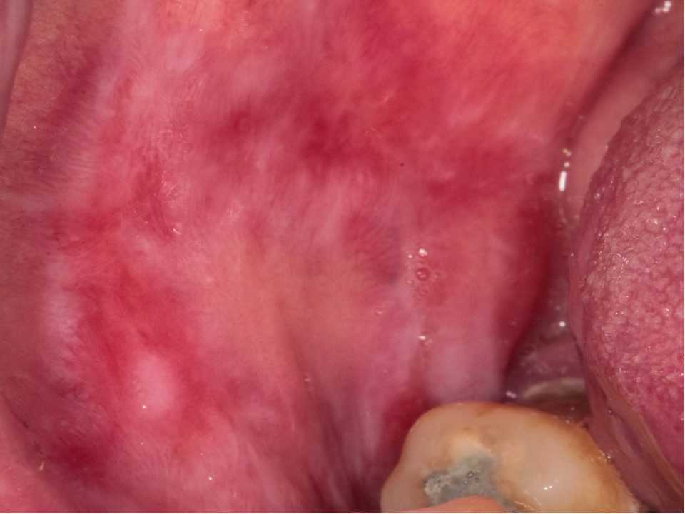 Oral pathology 5